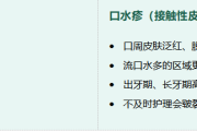 宝宝皮肤总出问题？这几种“痒”你真的了解吗？